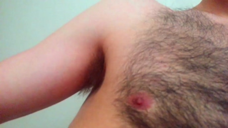 hormonemunster  20-02-2022